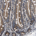 Immunohistochemical staining of human duodenum shows moderate granular cytoplasmic positivity in glandular cells.