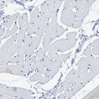 Immunohistochemical staining of human skeletal muscle shows no positivity in myocytes as expected.