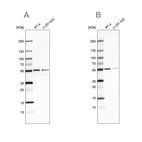 Western blot analysis using Anti-SHMT2 antibody HPA020543 (A) shows similar pattern to independent antibody HPA020549 (B).