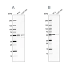 Western blot analysis using Anti-SHMT2 antibody HPA020543 (A) shows similar pattern to independent antibody HPA020549 (B).