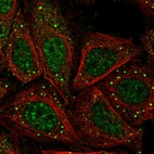 Immunofluorescent staining of human cell line SiHa shows localization to nucleoplasm & vesicles.