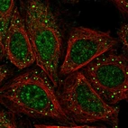 Immunofluorescent staining of human cell line SiHa shows localization to nucleoplasm & vesicles.