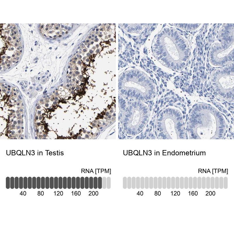 Anti-UBQLN3 Antibody