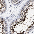 Immunohistochemical staining of human testis shows high expression.