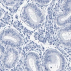 Immunohistochemical staining of human endometrium shows low expression as expected.