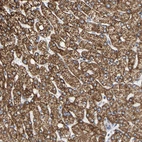 Immunohistochemical staining of human liver shows moderate granular cytoplasmic positivity in hepatocytes.