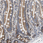 Immunohistochemical staining of human duodenum shows moderate granular cytoplasmic positivity in glandular cells.