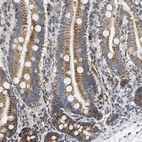 Immunohistochemical staining of human duodenum shows moderate granular cytoplasmic positivity in glandular cells.