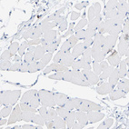 Immunohistochemical staining of human skeletal muscle shows no positivity in myocytes as expected.