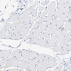 Immunohistochemical staining of human skeletal muscle shows no positivity in myocytes as expected.