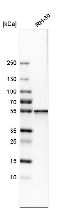 Western blot analysis in human cell line RH-30.