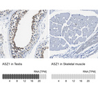 Anti-ASZ1 Antibody