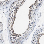 Immunohistochemical staining of human testis shows high expression.