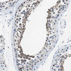 Immunohistochemical staining of human testis shows high expression.