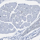 Immunohistochemical staining of human skeletal muscle shows low expression as expected.