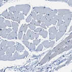 Immunohistochemical staining of human skeletal muscle shows low expression as expected.