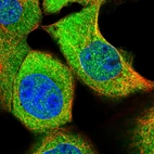 Immunofluorescent staining of human cell line A-431 shows localization to nucleoplasm & cytosol.