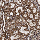 Immunohistochemical staining of human kidney shows strong cytoplasmic positivity in cells in tubules.