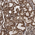 Immunohistochemical staining of human kidney shows strong cytoplasmic positivity in cells in tubules.