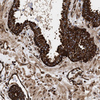 Immunohistochemical staining of human prostate shows strong cytoplasmic positivity in glandular cells.