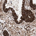 Immunohistochemical staining of human prostate shows strong cytoplasmic positivity in glandular cells.