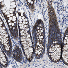 Immunohistochemical staining of human colon shows strong granular cytoplasmic positivity in glandular cells.