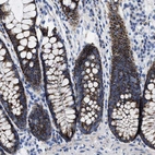 Immunohistochemical staining of human colon shows strong granular cytoplasmic positivity in glandular cells.