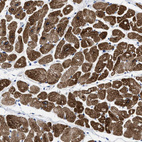 Immunohistochemical staining of human heart muscle shows strong granular cytoplasmic positivity in cardiomyocytes.