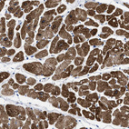 Anti-TBRG4 Antibody