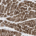 Immunohistochemical staining of human heart muscle shows strong granular cytoplasmic positivity in cardiomyocytes.