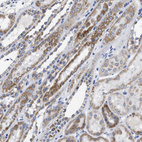 Immunohistochemical staining of human kidney shows moderate granular cytoplasmic positivity in cells in tubules.