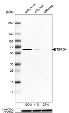 Western blot analysis in A-549 cells transfected with control siRNA, target specific siRNA probe #1 and #2, using Anti-TBRG4 antibody. Remaining relative intensity is presented. Loading control: Anti-GAPDH.