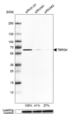 Western blot analysis in A-549 cells transfected with control siRNA, target specific siRNA probe #1 and #2, using Anti-TBRG4 antibody. Remaining relative intensity is presented. Loading control: Anti-GAPDH.