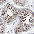 Immunohistochemical staining of human testis shows strong nuclear positivity in cells in seminiferous ducts.