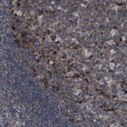 Immunohistochemical staining of human tonsil shows strong nuclear positivity in germinal center cells.