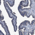 Immunohistochemical staining of human fallopian tube shows no nuclear positivity in glandular cells as expected.