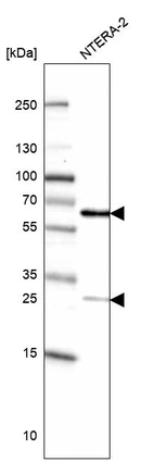Western blot analysis in human cell line NTERA-2.