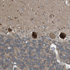 Immunohistochemical staining of human cerebellum shows moderate to strong cytoplasmic positivity in Purkinje cells.