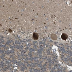 Immunohistochemical staining of human cerebellum shows moderate to strong cytoplasmic positivity in Purkinje cells.