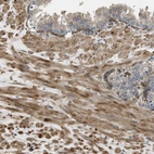 Immunohistochemical staining of human prostate shows moderate cytoplasmic positivity in smooth muscle cells.