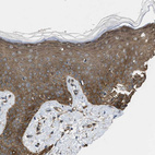 Immunohistochemical staining of human skin shows moderate cytoplasmic positivity in squamous epithelial cells.