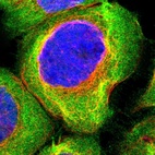Immunofluorescent staining of human cell line A-431 shows localization to plasma membrane & cytosol.