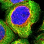 Immunofluorescent staining of human cell line A-431 shows localization to plasma membrane & cytosol.