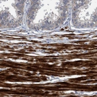 Immunohistochemical staining of human prostate shows strong cytoplasmic positivity in smooth muscle cells.