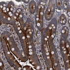 Immunohistochemical staining of human duodenum shows strong membranous and cytoplasmic positivity in glandular cells.