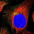 Immunofluorescent staining of human cell line U-2 OS shows localization to vesicles.