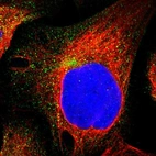 Immunofluorescent staining of human cell line U-2 OS shows localization to vesicles.