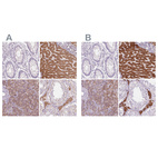 Immunohistochemical staining of human colon, liver, pancreas and testis using Anti-EPHX1 antibody HPA020593 (A) shows similar protein distribution across tissues to independent antibody HPA048847 (B).
