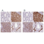 Immunohistochemical staining of human colon, liver, pancreas and testis using Anti-EPHX1 antibody HPA020593 (A) shows similar protein distribution across tissues to independent antibody HPA048847 (B).