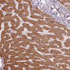 Anti-EPHX1 Antibody